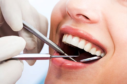 Dental Cleanings Exam 3 Advanced Dental Center Of Florence, Sc | Dr. Joseph Griffin