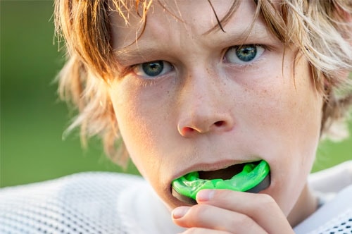 Mouthguards 1 Advanced Dental Center Of Florence, Sc | Dr. Joseph Griffin