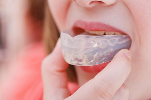 Custom Athletic Mouthguards Offer Better Fit, Protection
